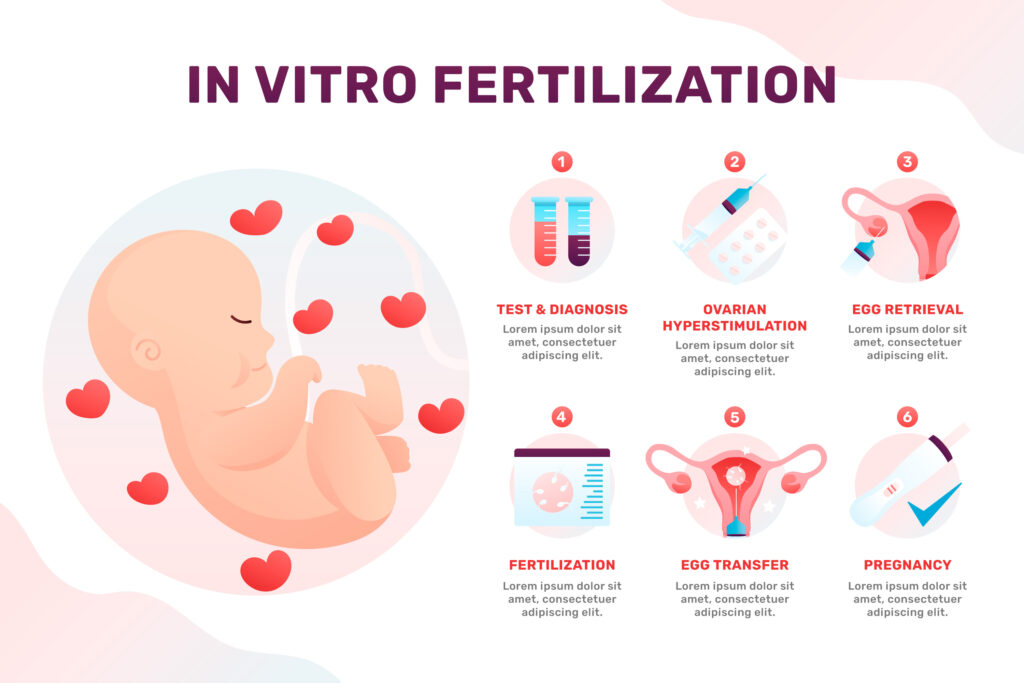 IVF Treatment. A Complete Breakdown