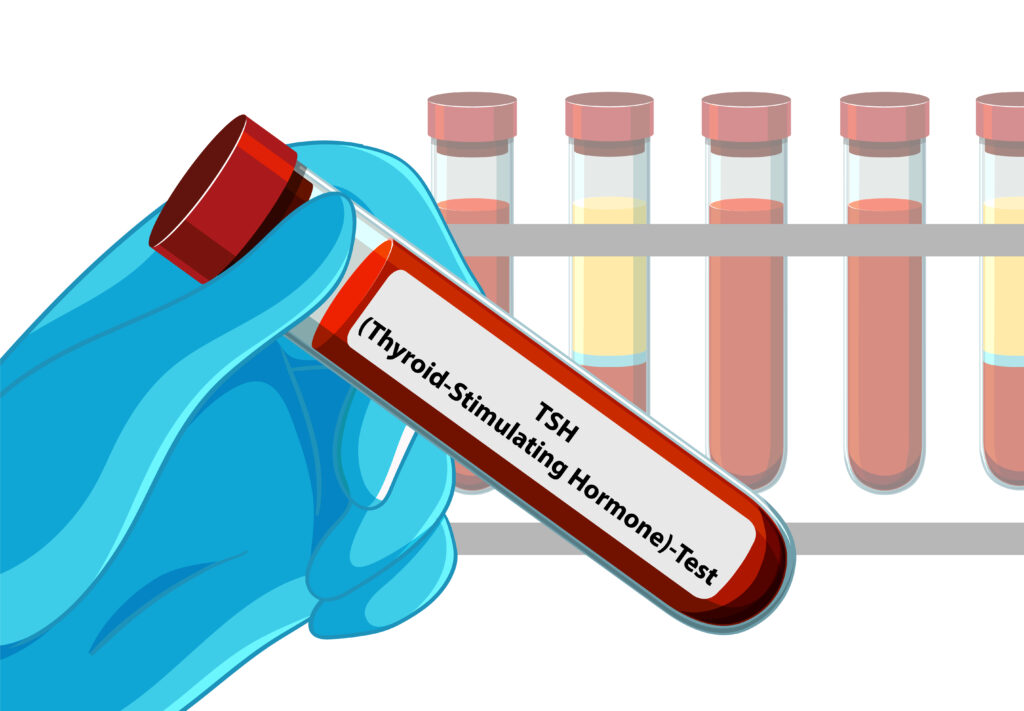 Hormonal Blood Tests to Assess Fertility